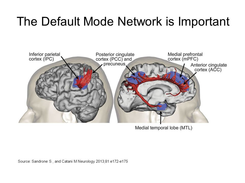 Chart showing the default mode network on an open brain